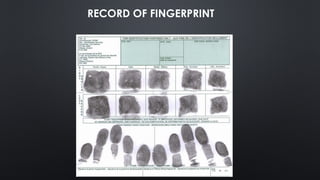 Dactylography is the study of fingerprints in human | PPTX
