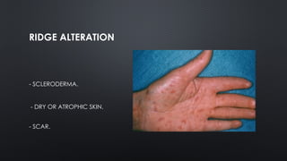 Dactylography is the study of fingerprints in human | PPTX