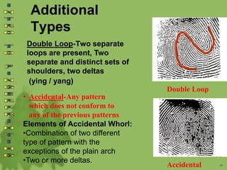 Additional
Types
Double Loop-Two separate
loops are present, Two
separate and distinct sets of
shoulders, two deltas
(ying / yang)
• Accidental-Any pattern
which does not conform to
any of the previous patterns
Elements of Accidental Whorl:
•Combination of two different
type of pattern with the
exceptions of the plain arch
•Two or more deltas. 46
Double Loop
Accidental
 
