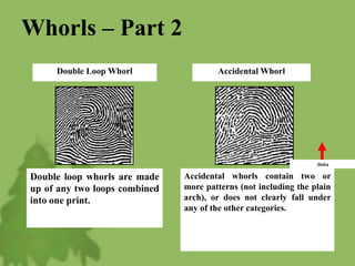 Whorls – Part 2
Accidental Whorl
Accidental whorls contain two or
more patterns (not including the plain
arch), or does not clearly fall under
any of the other categories.
Double Loop Whorl
Double loop whorls are made
up of any two loops combined
into one print.
Delta
 