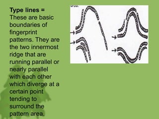 Type lines =
These are basic
boundaries of
fingerprint
patterns. They are
the two innermost
ridge that are
running parallel or
nearly parallel
with each other
which diverge at a
certain point
tending to
surround the
pattern area.
 