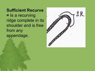 Sufficient Recurve
= Is a recurving
ridge complete in its
shoulder and is free
from any
appendage.
 
