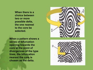 When there is a
choice between
two or more
possible delta,
the one nearest
to the core be
selected.
When a pattern shows a
series of bifurcation
opening towards the
core at the point of
divergences of the type
lines, the bifurcation
nearest the core is
chosen as the delta.
 