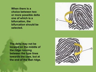 When there is a
choice between two
or more possible delta
one of which is a
bifurcation, the
bifurcation should be
selected.
The delta may not be
located on the middle of
the ridge running
between the type lines
towards the core, but at
the end of the that ridge.
 