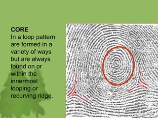 CORE
In a loop pattern
are formed in a
variety of ways
but are always
found on or
within the
innermost
looping or
recurving ridge.
 