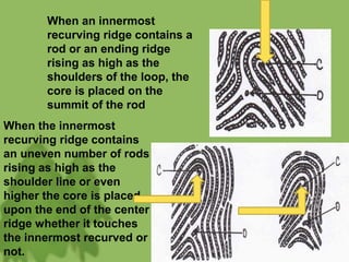 When an innermost
recurving ridge contains a
rod or an ending ridge
rising as high as the
shoulders of the loop, the
core is placed on the
summit of the rod
When the innermost
recurving ridge contains
an uneven number of rods
rising as high as the
shoulder line or even
higher the core is placed
upon the end of the center
ridge whether it touches
the innermost recurved or
not.
 