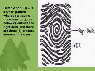 Outer Whorl (O) – is
a whorl pattern
whereby a tracing
ridge runs or gores
below or outside the
right delta and there
are three (3) or more
intervening ridges.
 