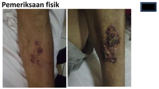 Pemeriksaan fisik
 