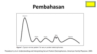 Pembahasan




Theodore X, et al. Understanding and Interpreting Serum Protein Electrophoresis. American Family Physician. 2005
 