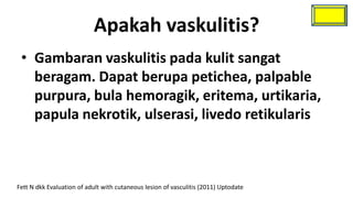 Apakah vaskulitis?
 • Gambaran vaskulitis pada kulit sangat
   beragam. Dapat berupa petichea, palpable
   purpura, bula hemoragik, eritema, urtikaria,
   papula nekrotik, ulserasi, livedo retikularis



Fett N dkk Evaluation of adult with cutaneous lesion of vasculitis (2011) Uptodate
 
