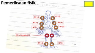 Pemeriksaan fisik

                                NT (+)          NT (+)


                              NT (+)               NT (+)

                              NT (+)                 NT (+)



       NT (+) Krepitasi (-)



                                       NT (+)       NT (+)
 