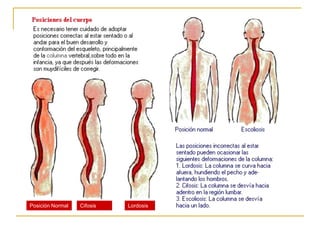 Posición Normal   Cifosis   Lordosis
 