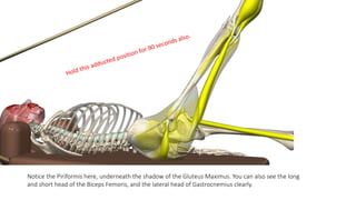 Notice the Piriformis here, underneath the shadow of the Gluteus Maximus. You can also see the long
and short head of the Biceps Femoris, and the lateral head of Gastrocnemius clearly.
 