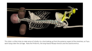 This slide is a little tricky to make sense of initially. Its a shot looking up from the posterior aspect of the stretchee, as if you
were lying under the carriage. Note the Piriformis, the long head of Biceps Femoris and the Gastrocnemius.
 