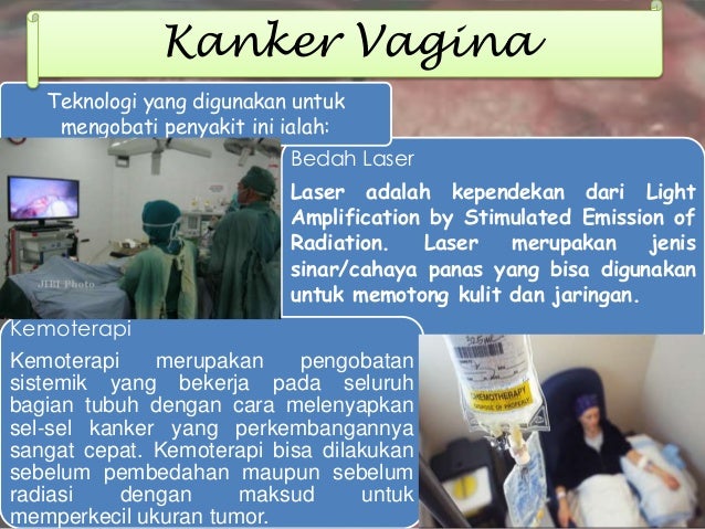 Teknologi dalam Penyembuhan Penyakit pada Sistem Reproduksi