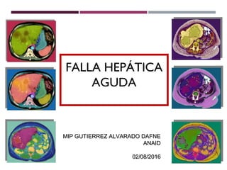 FALLA HEPÁTICA
AGUDA
MIP GUTIERREZ ALVARADO DAFNEMIP GUTIERREZ ALVARADO DAFNE
ANAIDANAID
02/08/201602/08/2016
 