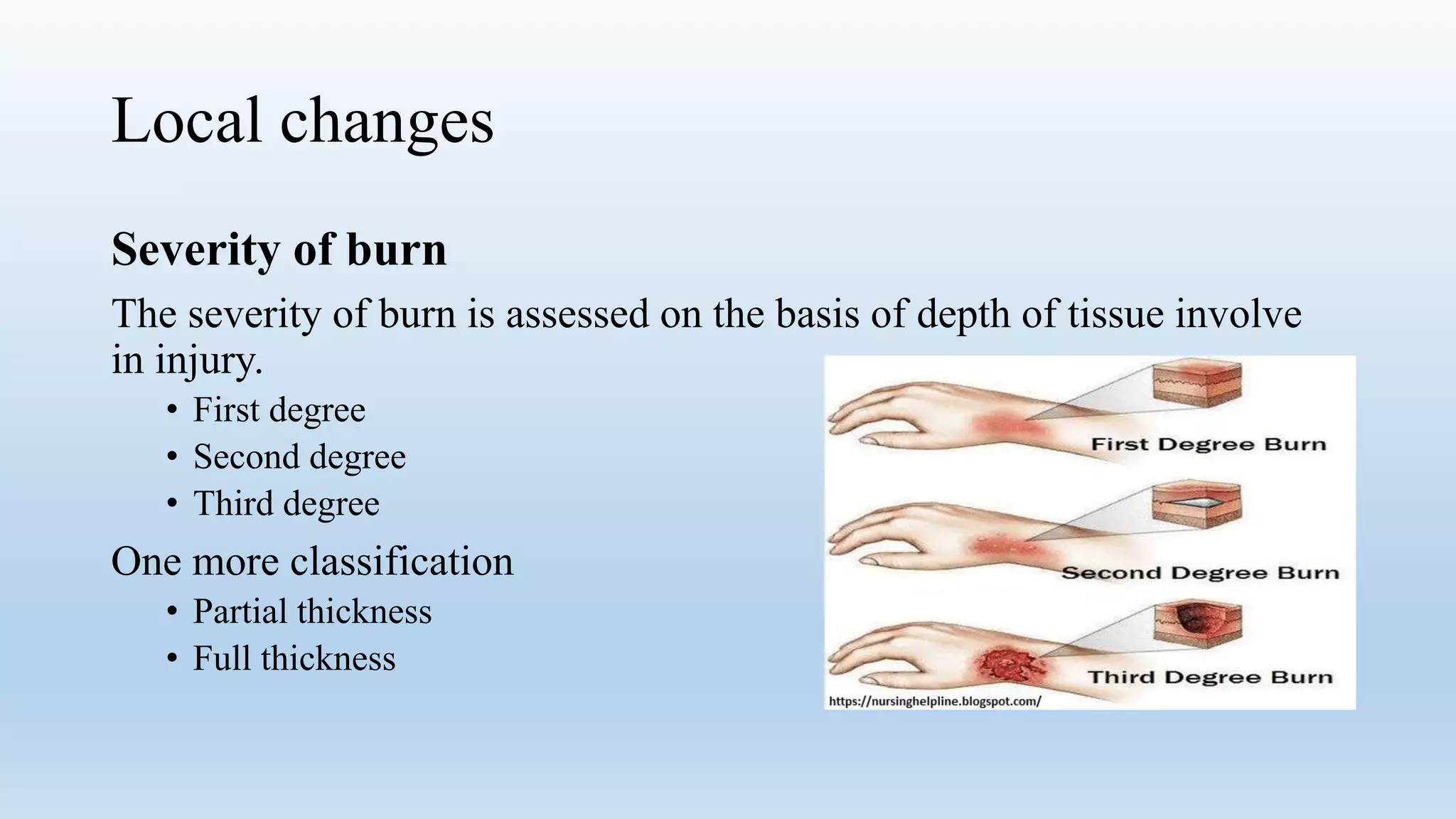 Burn Injury classification and management | PPTX