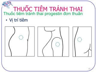 Dai cuong ve bptt sv (2)