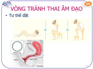 Dai cuong ve bptt sv (2)