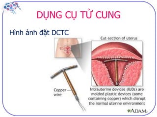 Dai cuong ve bptt sv (2)