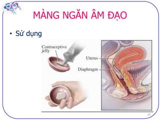 Dai cuong ve bptt sv (2)
