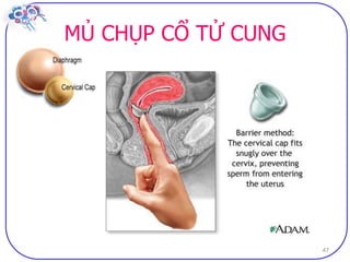 Dai cuong ve bptt sv (2)