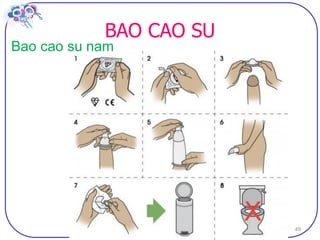 Dai cuong ve bptt sv (2)
