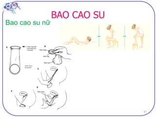 Dai cuong ve bptt sv (2)