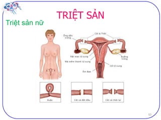 Dai cuong ve bptt sv (2)