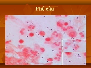 Phế cầu
 