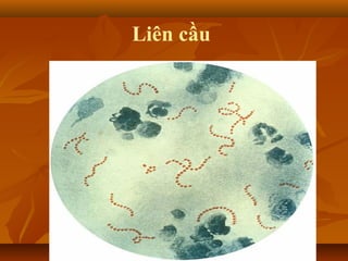 Liên cầu
 