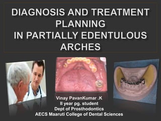 Vinay PavanKumar .K
II year pg. student
Dept of Prosthodontics
AECS Maaruti College of Dental Sciences
 