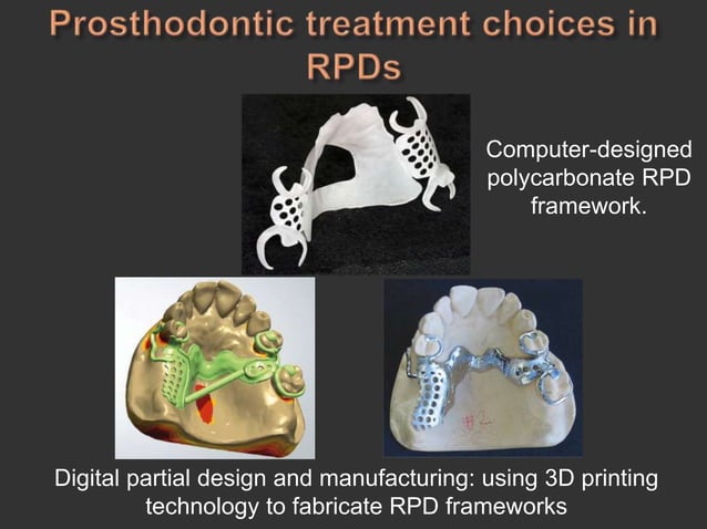 Diagnosis and treatment planning in removable partial denture | PPTX