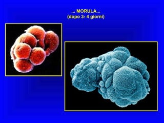 ... MORULA...
(dopo 3- 4 giorni)

 