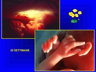 20 SETTIMANE

 