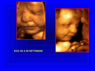 ECO 3D A 28 SETTIMANE

 
