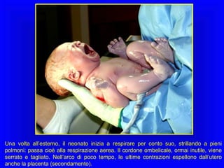Una volta all’esterno, il neonato inizia a respirare per conto suo, strillando a pieni
polmoni: passa cioè alla respirazione aerea. Il cordone ombelicale, ormai inutile, viene
serrato e tagliato. Nell’arco di poco tempo, le ultime contrazioni espellono dall’utero
anche la placenta (secondamento).

 