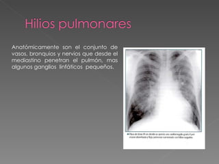pediculo pulmonar