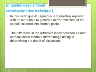 air guided deep stromal
technique(melles technique)
• In this technique AC aqueous is completely replaced
with an air bubble to generate mirror reflection of the
spatula inserted into stromal pocket.
• The difference in the refractive index between air and
corneal tissue create a mirror image aiding in
determining the depth of dissection.
 