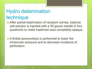 Hydro delamination
technique
 After partial trephination of recipient cornea, balance
salt solution is injected with a 30 gauze needle in four
quadrants to make trephined area completely opaque.
 A limbal paracentesis is performed to lower the
intraocular pressure and to decrease incidence of
perforation.
 