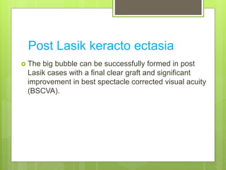 Post Lasik keracto ectasia
 The big bubble can be successfully formed in post
Lasik cases with a final clear graft and significant
improvement in best spectacle corrected visual acuity
(BSCVA).
 