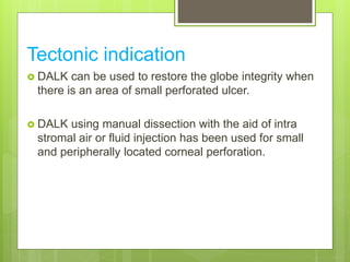 Tectonic indication
 DALK can be used to restore the globe integrity when
there is an area of small perforated ulcer.
 DALK using manual dissection with the aid of intra
stromal air or fluid injection has been used for small
and peripherally located corneal perforation.
 