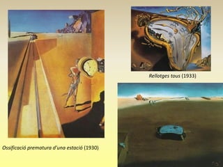 Rellotges tous (1933)




Ossificació prematura d'una estació (1930)
 