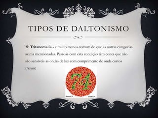 TIPOS DE DALTONISMO
 Tritanomalia - é muito menos comum do que as outras categorias
acima mencionadas. Pessoas com esta condição têm cones que não
são sensíveis as ondas de luz com comprimento de onda curtos
(Azuis)
 