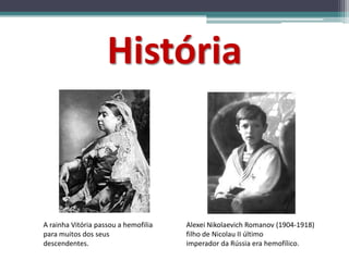 História
A rainha Vitória passou a hemofilia
para muitos dos seus
descendentes.
Alexei Nikolaevich Romanov (1904-1918)
filho de Nicolau II último
imperador da Rússia era hemofílico.
 