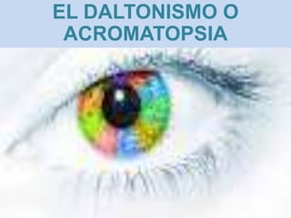 EL DALTONISMO O
ACROMATOPSIA

 