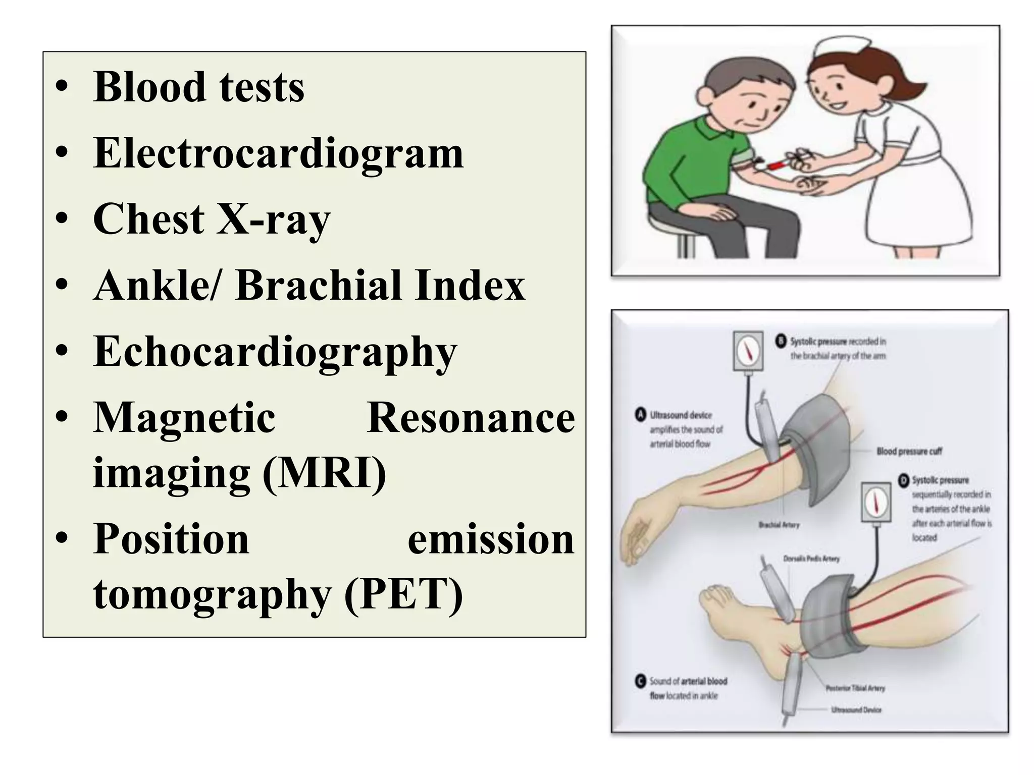 • Blood tests
• Electrocardiogram
• Chest X-ray
• Ankle/ Brachial Index
• Echocardiography
• Magnetic Resonance
imaging (MRI)
• Position emission
tomography (PET)
 