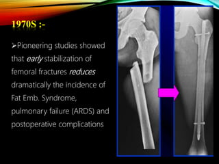 1970S :-
Pioneering studies showed
that early stabilization of
femoral fractures reduces
dramatically the incidence of
Fat Emb. Syndrome,
pulmonary failure (ARDS) and
postoperative complications
 