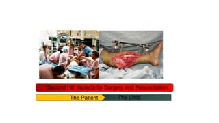 ‘Second Hit’ Impacts by Surgery and Resuscitation
The Patient The Limb
 