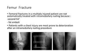 Femur Fracture
• Femoral fractures in a multiply injured patient are not
automatically treated with intramedullary nailing because :
-second hit’
- fat emboli
• Patients with a chest injury are most prone to deterioration
after an intramedullary nailing procedure
 